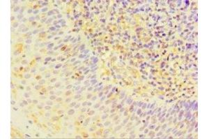 Immunohistochemistry of paraffin-embedded human tonsil tissue using ABIN7170823 at dilution of 1:100 (Striatin anticorps  (AA 581-780))