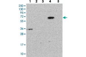Western blot analysis of Lane 1: RT-4, Lane 2: U-251 MG, Lane 3: Human Plasma, Lane 4: Liver, Lane 5: Tonsil with ARHGAP19 polyclonal antibody . (ARHGAP19 anticorps)