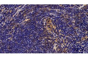 Detection of CLC in Mouse Spleen Tissue using Polyclonal Antibody to Charcot Leyden Crystal Protein (CLC)