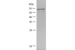Western Blotting (WB) image for Histone Deacetylase 1 (HDAC1) (AA 183-482) protein (GST tag) (ABIN7123342) (HDAC1 Protein (AA 183-482) (GST tag))
