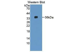 Western blot analysis of the recombinant protein. (AGRN anticorps  (AA 1130-1401))