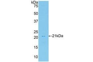 Detection of Recombinant HGF, Rat using Polyclonal Antibody to Hepatocyte Growth Factor (HGF)