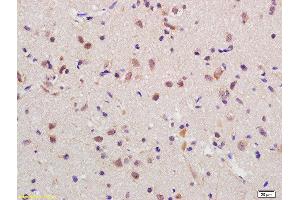Formalin-fixed and paraffin embedded rat brain labeled with Anti-RGC32 Polyclonal Antibody, Unconjugated  at 1:200 followed by conjugation to the secondary antibody and DAB staining (RGC32 anticorps  (AA 98-137))