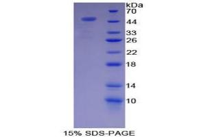 SDS-PAGE analysis of Pig Complement Component 7 Protein. (C7 Protéine)