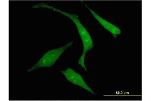 Immunofluorescence of monoclonal antibody to RGS14 on HeLa cell. (RGS14 anticorps  (AA 1-566))
