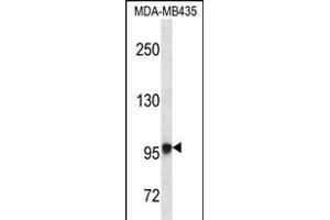 EXTL3 Antibody (N-term) (ABIN656662 and ABIN2845903) western blot analysis in MDA-M cell line lysates (35 μg/lane).