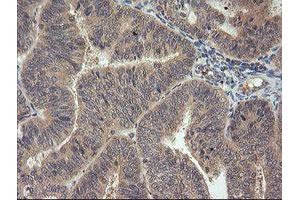 Image no. 1 for anti-Mitogen-Activated Protein Kinase Kinase 3 (MAP2K3) antibody (ABIN1499401)