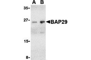 Western Blotting (WB) image for anti-B-Cell Receptor-Associated Protein 29 (BCAP29) (Middle Region) antibody (ABIN1030881) (BCAP29 anticorps  (Middle Region))