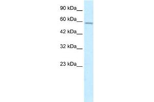 WB Suggested Anti-MGC4618 Antibody Titration:  0. (TMEM175 anticorps  (N-Term))