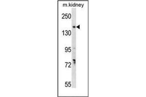 Western blot analysis of GREB1 Antibody  in mouse kidney tissue lysates (35ug/lane). (GREB1 anticorps  (Middle Region))