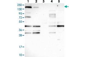 Western blot analysis of Lane 1: RT-4, Lane 2: U-251 MG, Lane 3: Human Plasma, Lane 4: Liver, Lane 5: Tonsil with SH3TC1 polyclonal antibody .