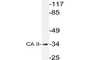 Western blot analysis of Carbonic anhydrase 2 antibody in extracts from rat heart cells.
