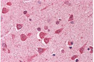 Human Brain, Cortex (formalin-fixed, paraffin-embedded) stained with ING1 antibody ABIN290441 at 2. (ING1 anticorps  (AA 285-296))