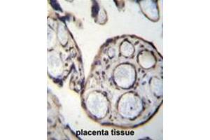 CAPN6 Antibody (Center) immunohistochemistry analysis in formalin fixed and paraffin embedded human placenta tissue followed by peroxidase conjugation of the secondary antibody and DAB staining.