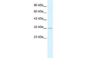 WB Suggested Anti-PSMD14 Antibody Titration:  0. (PSMD14 anticorps  (C-Term))