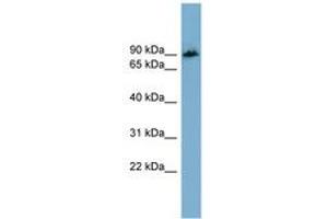 Image no. 1 for anti-Amyloid beta (A4) Precursor Protein-Binding, Family B, Member 1 Interacting Protein (APBB1IP) (AA 71-120) antibody (ABIN6744167) (Amyloid beta (A4) Precursor Protein-Binding, Family B, Member 1 Interacting Protein (APBB1IP) (AA 71-120) anticorps)