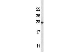 IL-22 antibody western blot analysis in K562 lysate