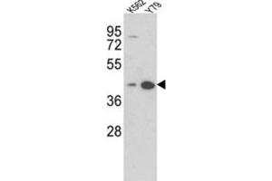 Western Blotting (WB) image for anti-alpha-2-Glycoprotein 1, Zinc-Binding (AZGP1) antibody (ABIN3002718)