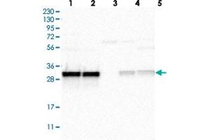Western blot analysis of Lane 1: RT-4, Lane 2: U-251 MG, Lane 3: Human Plasma, Lane 4: Liver, Lane 5: Tonsil with MRPL45 polyclonal antibody  at 1:250-1:500 dilution.