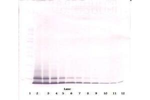 Image no. 1 for anti-Chemokine (C-X-C Motif) Ligand 1 (Melanoma Growth Stimulating Activity, Alpha) (CXCL1) antibody (ABIN465459) (CXCL1 anticorps)
