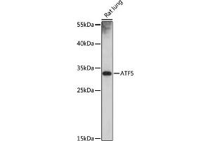 Western blot analysis of extracts of rat lung, using  antibody (ABIN7265407) at 1:1000 dilution. (ATF5 anticorps)