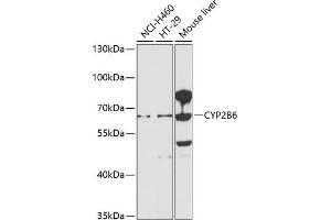Western blot analysis of extracts of various cell lines, using CYP2B6 antibody (ABIN1679474, ABIN5663912, ABIN5663914 and ABIN6218554) at 1:1000 dilution.