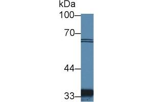 Detection of SLC30A8 in Human Hela cell lysate using Polyclonal Antibody to Solute Carrier Family 30 Member 8 (SLC30A8) (SLC30A8 anticorps  (AA 263-369))