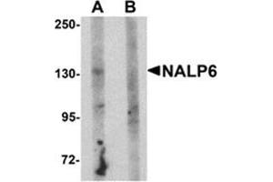 Western blot analysis of NALP5 in mouse brain tissue lysate with NALP5 antibody at 1 μg/ml in (A) the absence and (B) the presence of blocking peptide. (NLRP6 anticorps  (N-Term))