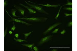 Immunofluorescence of monoclonal antibody to DYRK1B on HeLa cell.