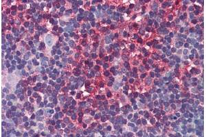 Human Thymus: Formalin-Fixed, Paraffin-Embedded (FFPE) (Arrestin 3 anticorps  (AA 300-410))