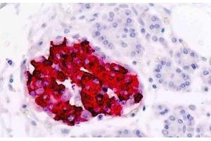 Human Pancreas, Islets of Langerhans: Formalin-Fixed, Paraffin-Embedded (FFPE) (Insulin anticorps)