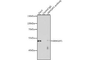 Immunoprecipitation analysis of 200 μg extracts of HeLa cells, using 3 μg  antibody (ABIN1678739, ABIN3018026, ABIN3018027 and ABIN6220339). (ARHGAP1 anticorps  (AA 210-439))