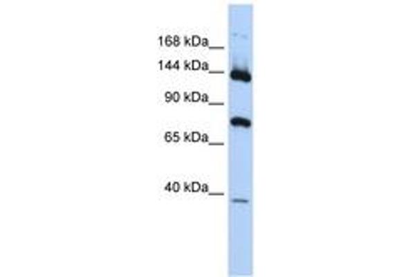 JMJD7 anticorps  (AA 179-228)