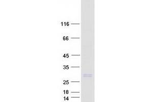 Validation with Western Blot