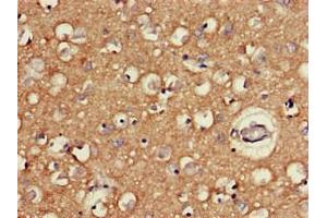 Immunohistochemistry of paraffin-embedded human brain tissue using ABIN7166533 at dilution of 1:100 (FAT3 anticorps  (AA 1209-1470))