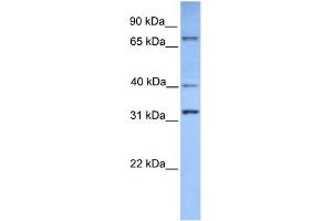 WB Suggested Anti-SUZ12 Antibody Titration:  0. (SUZ12 anticorps  (Middle Region))