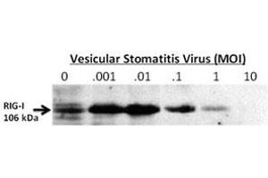 Western blot testing of RIG-I antibody 24-hour post infection of primary murine microglia cells (2x10e6) untreated (0) or exposed to vesicular stomatitis virus at a range of viral particle/cell ratios.