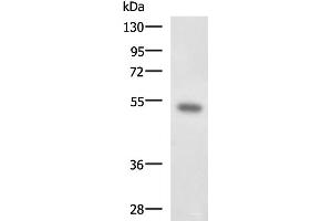 Western blot analysis of Mouse kidney tissue lysate using FOXQ1 Polyclonal Antibody at dilution of 1:650 (FOXQ1 anticorps)