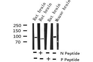 Western blot analysis of Phospho-Dynamin-1 (Ser774) expression in various lysates (Dynamin 1 anticorps  (pSer774))