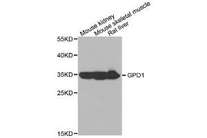 Western blot analysis of extracts of various cell lines, using GPD1 antibody. (GPD1 anticorps)