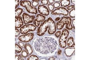 Immunohistochemical staining of human kidney with ADAT1 polyclonal antibody  shows strong cytoplasmic positivity in cells in tubules.