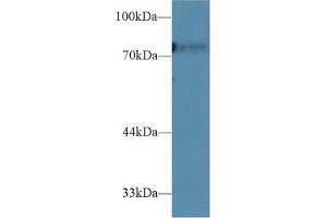 Detection of CD2AP in Rat Liver lysate using Polyclonal Antibody to CD2 Associated Protein (CD2AP) (CD2AP anticorps  (AA 368-623))
