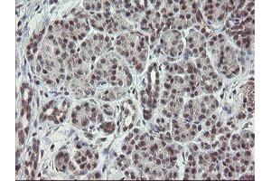 Image no. 8 for anti-Golgin, RAB6-Interacting (GORAB) (AA 35-394) antibody (ABIN1491441)