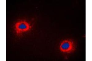 Immunofluorescent analysis of NIP1 staining in COLO205 cells. (BNIP1 anticorps  (C-Term))