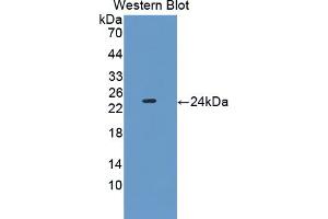 Western blot analysis of the recombinant protein. (PEBP1 anticorps  (AA 2-187))