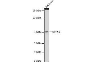 Western blot analysis of extracts of Rat brain, using NUP62 antibody (ABIN7269045) at 1:1000 dilution. (NUP62 anticorps)