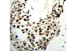 LIN28A antibody immunohistochemistry analysis in formalin fixed and paraffin embedded human testis tissue.