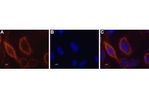 Expression of STIM1 in RBL cells - Cell surface detection of STIM1 in live rat basophilic leukemia (RBL) cells.