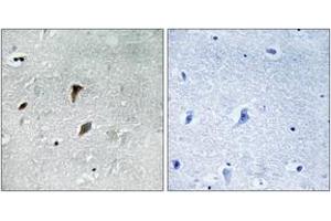 Immunohistochemistry analysis of paraffin-embedded human brain, using MAP2K3 (Phospho-Thr222) Antibody.