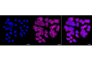 Immunocytochemical staining of HepG2 cells with EIF2B5 antibody (ABIN7798515), 1:).